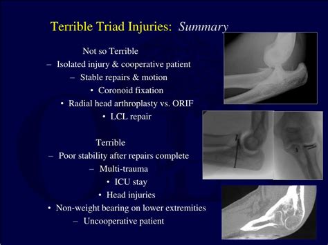 Terrible Triad Injury of Elbow .
